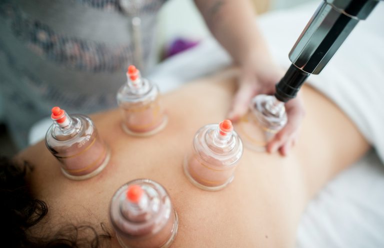Physical therapies like cupping are perfomed at a Traditional Chinese Medicine clinic